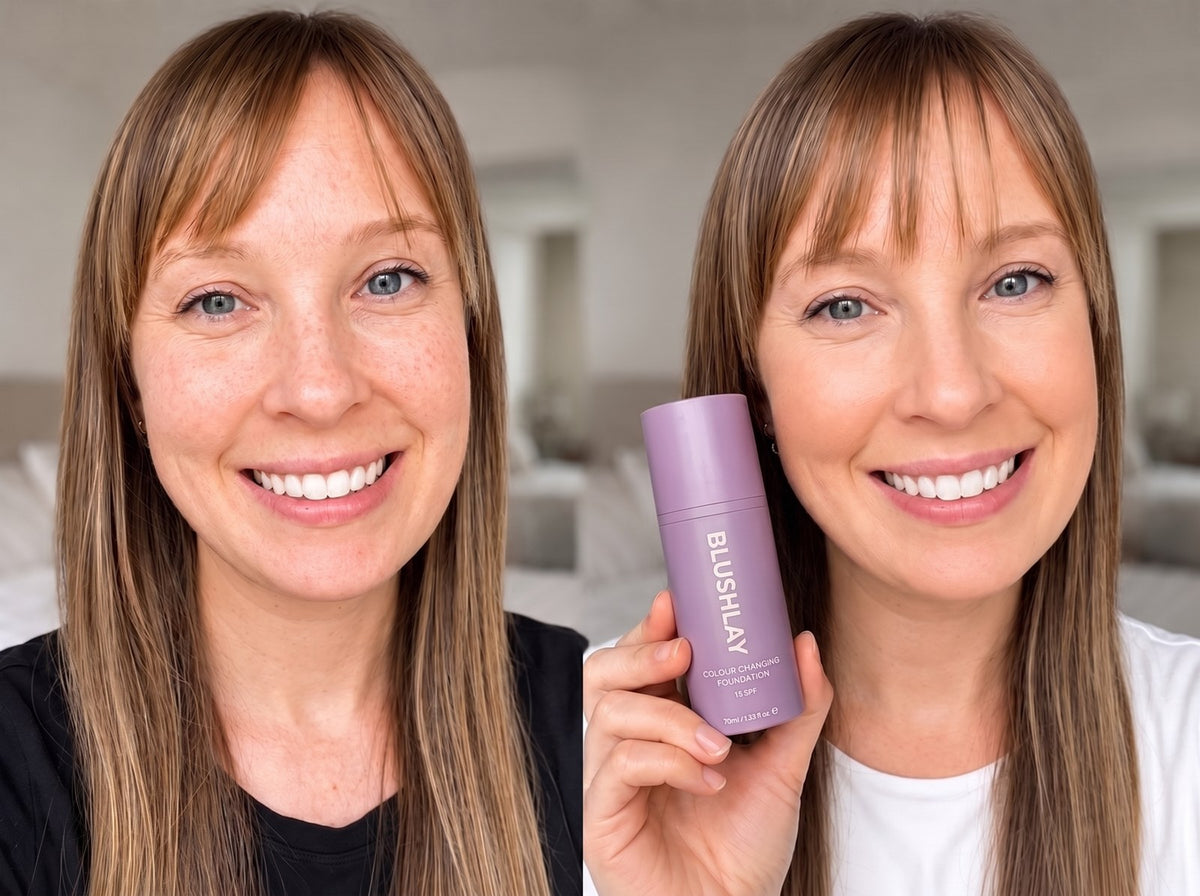 Gemma H. before and after