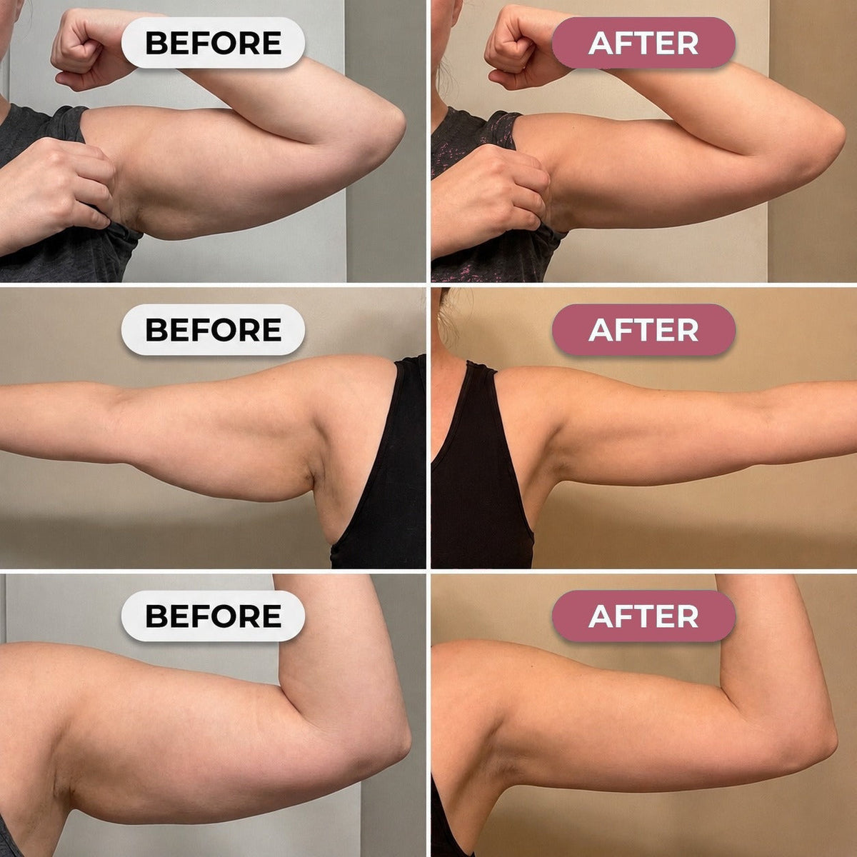 Blushlay Arm Sculpt Sleeve
