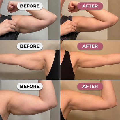 Blushlay Arm Sculpt Sleeve