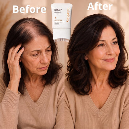 BLUSHLAY® Stop Hair Loss. Regrow Your Hair