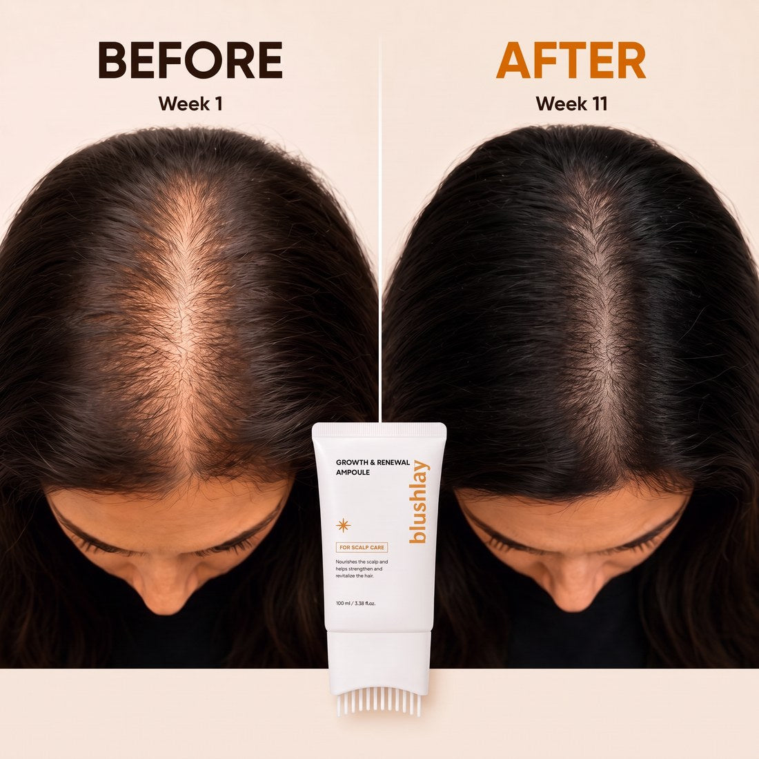 BLUSHLAY® Stop Hair Loss. Regrow Your Hair