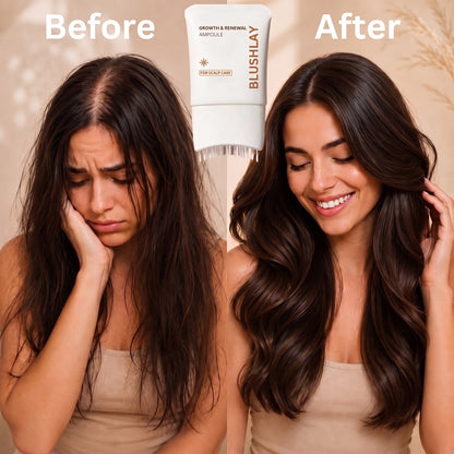 BLUSHLAY® Stop Hair Loss. Regrow Your Hair